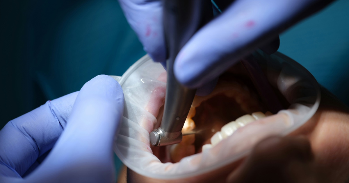 oral surgery services page